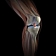 Эффективность и безопасность лечения остеоартроза коленного сустава Нолтрексом – полимером с перекрестными связями