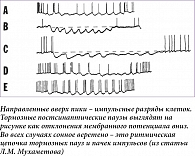 Колебания мембранного потенциала у пяти (A, B, C, D, E) различных клеток таламуса крысы во время сонных веретен
