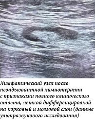 Рис. 2.