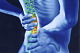 Фасеточный синдром как причина боли в спине