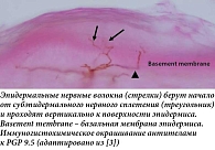 Рис. 1. Нервные волокна эпидермиса и сосочкового слоя дермы.