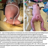 Рис. 1. Местные проявления заболевания: