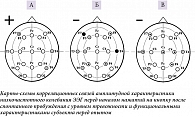 Рис. 2. Обозначения, как на рис. 1