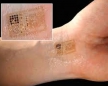 Ученые разработали "электронную кожу" - терапевтический пластырь нового поколения