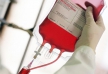 Европейские ученые подтвердили трансфузионный путь передачи для болезни Крейтцфельдта-Якоба