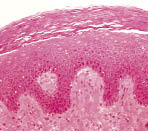 Рис. 2. Световая микрофотография малых половых губ (автор J. Burbidge “Sciencephotolibrary”)