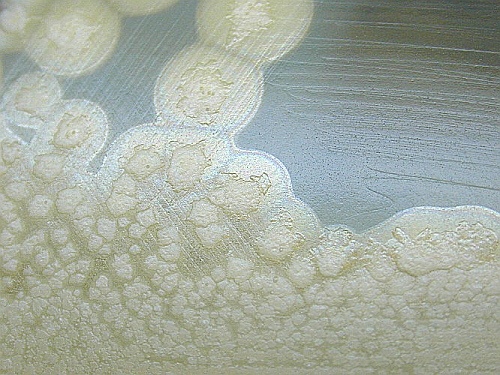 Колония ботулины (Clostridium botulinum). Фото Larry Stauffer, Oregon State Public Health Laboratory.