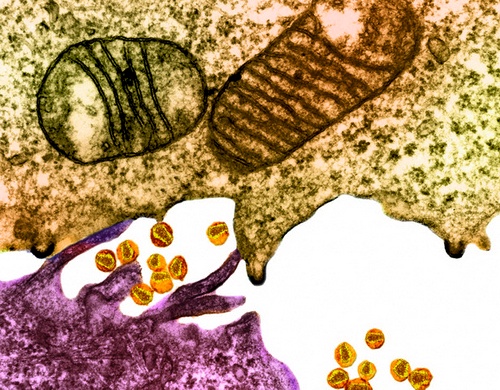 ВИЧ между эпителиальной клеткой (снизу) и лимфоцитом (сверху) (фото Visuals Unlimited / Corbis)