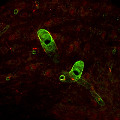 Кровеносные сосуды мозга: зелёным окрашены клетки стенки сосудов, красными точками выделены связанные с ними перициты. (Фото wellcome images)
