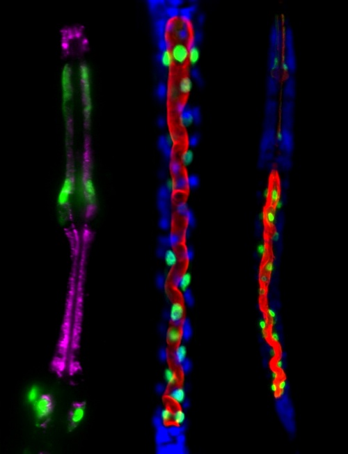 То, что тип клеток стал другим, было установлено в том числе по изменению флюоресценции — с фиолетовой, характерной для клеток глотки (слева), на красную, типичную для кишечника (в центре). Справа показана нематода «в полный рост» с настоящим кишечником, светящимся тоже красным. (Фото авторов работы)