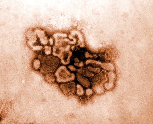 Вирус свиного гриппа. (Фото CDC / Dr. Terrence Tumpey)