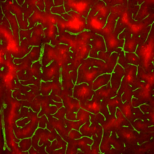 Кровеносные сосуды (зелёные) в ткани мозга молодых мышей; участки, испытывающие недостаток кислорода, окрашены ярко-красным. (Фото авторов работы)