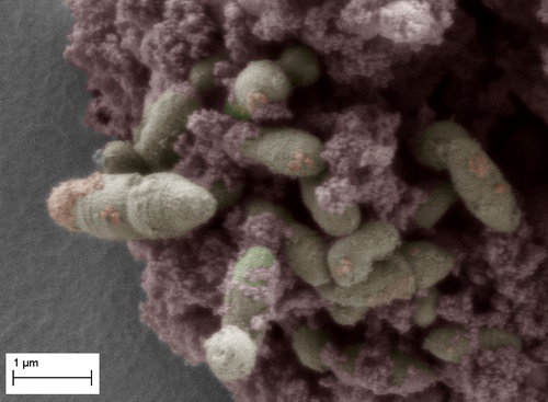 Бактерии R. gnavus (фото Kathryn Cross / Institute of Food Research).