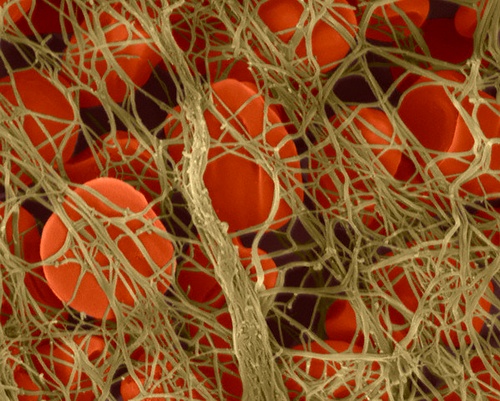 Эритроциты, запутавшиеся в фибриновых нитях (фото Dennis Kunkel Microscopy)