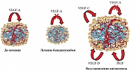 Рис. 5. Гипотеза: перекрестные VEGF лиганды ассоциированы с резистентностью к анти-VEGF терапии у пациентов с метастатическим колоректальным раком
