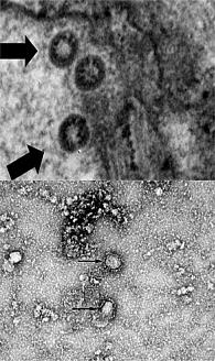Рис. 5. Электронно-микроскопическая фотография SARS-CoV-2 (изолят из ротоглоточного смыва пациента с первым лабораторно подтвержденным диагнозом COVID-19 на территории Республики Корея)