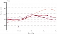 Рис. 1. Время пиков постпрандиальной гликемии после обеда у беременной с СД типа 1  в течение 3-х дней наблюдения