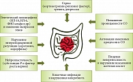 Рис. 3. Ключевые факторы патогенеза СРК