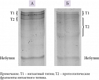 Рис. 3. ДСН-гель-электрофорез белков скелетной мышцы (2,2%-ный полиакриламидный гель, укрепленный агарозой (8,0 × 10,0 × 0,10 см)): содержание титина и небулина в musculus erector spinae – нормальное в контрольной группе (А), сниженное при МФБС (Б)