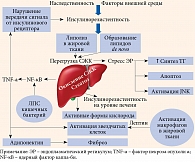 Рис. 1. Основные патогенетические звенья неалкогольной жировой болезни печени