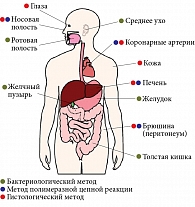 Рис. 1. Helicobacter pylori и экстрагастродуоденальные заболевания и состояния, при которых патогенетическая роль инфекции исследуется