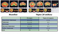 Рисунок 5. Динамика перфузии головного мозга у пациентов с МС на фоне снижения массы тела на 16 кг (14%) при 24-недельном приеме препарата Ксеникал