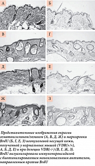 Рис. 4. Результат воздействия канцерогена ДМБА на пролиферативный маркер BrdU у мышей с делецией VDR(-/-).