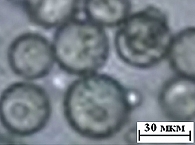Рис. 2. Световая микроскопия: биополимерные микросферы с инкапсулированным дексаметазоном на основе  ПОБ (средний размер микросфер 39,6 ± 9,3 мкм, массовая доля включенного ЛВ 9,8 ± 3,0%)