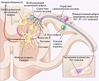 Рис. 2. Патогенетические механизмы формирования болевого синдрома при невропатической боли. Ноцицептивные нейроны, расположенные в ганглиях заднего корешка и синаптически связанные со вставочными нейронами спинного мозга, активизируют последние
