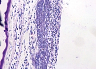 Рис. 2. Слизистая оболочка носа после введения формалина. Выраженная инфильтрация нейтрофилами поверхностных слоев эпителия, отек подслизистой. Окраска толуидиновым синим, 400-кратное увеличение