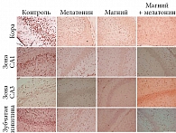 Рис. 7. Иммуногистохимическое окрашивание на каспазу-3 в различных регионах гиппокампа