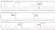 Рис. 1. Хроматограммы нуклеотидных последовательностей ДНК культур H. pylori, демонстрирующие переходные состояния в гене gyrA