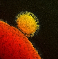 Вирус MERS (изображение Rocky Mountain Laboratories, National Institute of Allergy and Infectious Diseases, NIH).