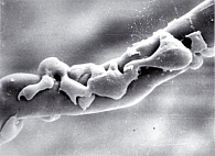 Рисунок 3. Изменившую форму гладкие миоциты на контуре пещеристых тел полового члена экспериментального животного группы 1 через 6 месяцев после начала опыта (нейротомии). СЭМКПх30