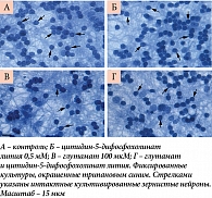 Рис. 12. Культивированные зернистые нейроны мозжечка крыс при действии глутамата и цитидин-5-дифосфохолината лития