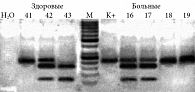 Рис. 1. Примеры анализа полиморфного маркера C3435T гена АBСB1 в 10%-ном полиакриламидном геле: Н2О – отрицательный контроль (dd вода), К+ – образец до обработки рестриктазой, M – Lad 50 – маркер с шагом полос 50 п.н.