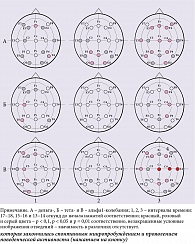 Рис. 4. Карты-схемы различий спектральных характеристик дельта-, тета- и альфа1-колебаний по областям отведения ЭЭГ в начале активации мозга,