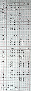 Рис. 7. Результат рефрактометрии и кератометрии в динамике