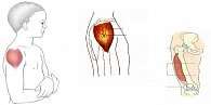 Рисунок 9. Место для в/м введения –  Дельтовидная мышца (предпочтительный участок) Vastus lateralis Muscle (альтернативное место)