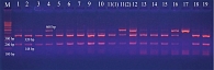 Пример результатов ПЦР/ПДРФ-анализа целевого участка c.276G>T (rs1501299) гена ADIPOQ (M – молекулярный маркер, 1–19 – исследуемые образцы)