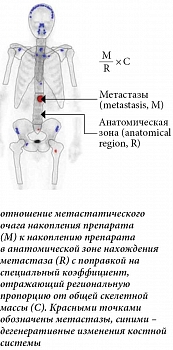 Рис. 1. Методика подсчета bone scan index (BSI) – отношение метастатического очага накопления препарата (M) к накоплению препарата в анатомической зоне нахождения метастаза (R) с поправкой на специальный коэффициент, отражающий региональную пропорцию от о